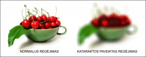 Sergant katarakta delsti negalima